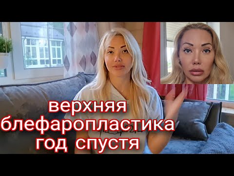 Видео: Моя Блефаропластика после 1 года/все плюсы и минусы/Результат/Повторила бы снова?