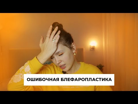 Видео: Я сделала ОШИБОЧНУЮ БЛЕФАРОПЛАСТИКУ, чтобы избавиться от синяков, но они стали ЕЩЕ БОЛЬШЕ!