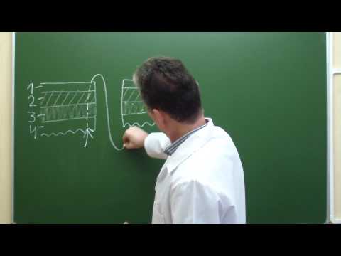 Видео: Схема непрерывного скорняжного шва Шмидена на переднюю губу межкишечного анастомоза