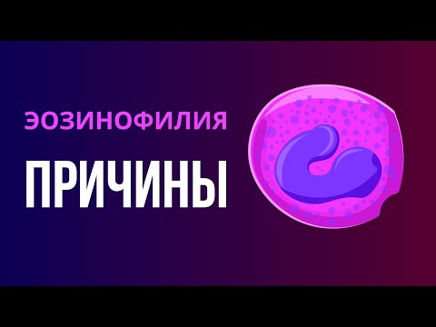 Видео: Эозинофилия. Каковы причины повышения эозинофилов. Диагностика эозинофильного лейкоцитоза