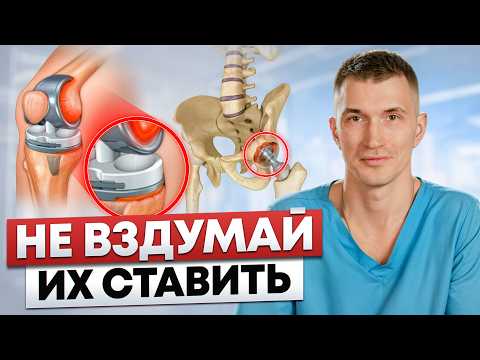 Видео: Как обойтись без замены сустава?