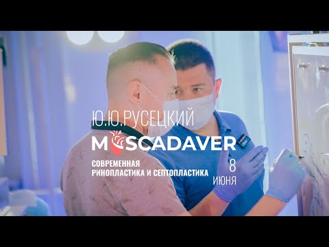 Видео: Современная ринопластика и септопластика