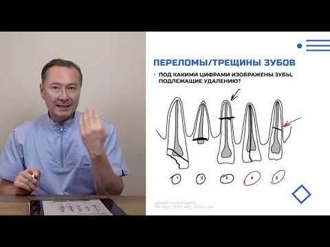 Видео: Модуль 1  Урок 3   Показания и противопоказания к удалению зубов