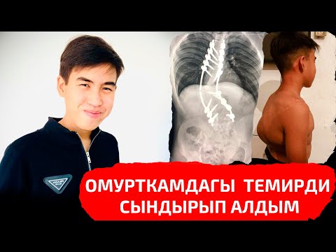 Видео: Омурткама салдырган темир сынып кетти