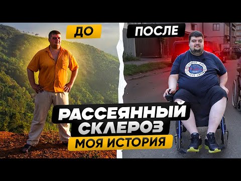 Видео: НЕМЕЛА РУКА, а оказалось Рассеянный Склероз: МОЯ ИСТОРИЯ