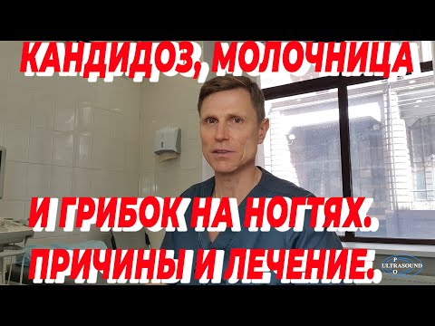 Видео: Кандидоз, молочница и грибок на ногтях. Причины и лечение.