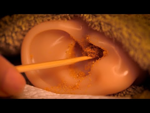 Видео: [ASMR] Глубокая чистка ушей с вытягиванием из ушей (ACMP / оба уха / молчание)