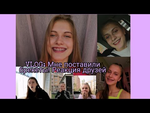 Видео: Мне поставили брекеты! Реакция друзей/Почему я держала это все в секрете?