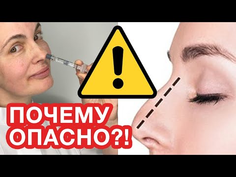 Видео: КОРРЕКЦИЯ НОСА ИЛИ КОНТУРНАЯ ПЛАСТИКА ФИЛЛЕРОМ И НИТЯМИ!  ПОЧЕМУ ОПАСНО?! - ОТВЕТ КОСМЕТОЛОГА
