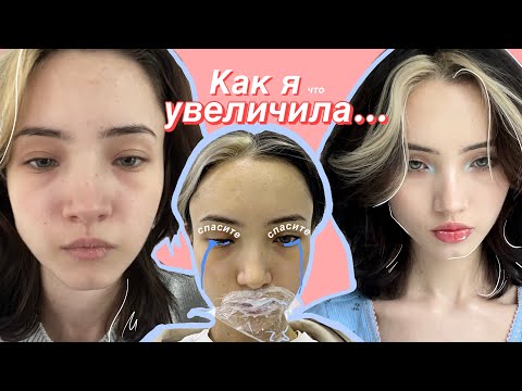 Видео: Как я увеличила губы (нервно)