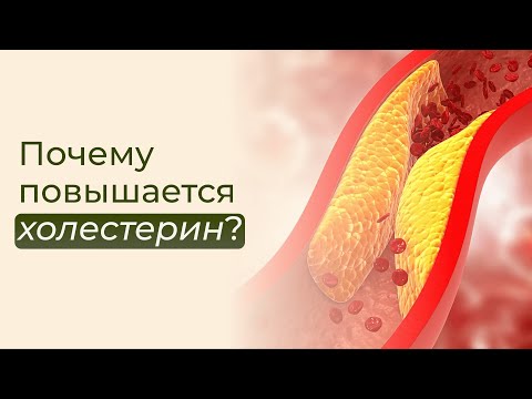 Видео: Для чего нужен холестерин и ОПАСЕН ЛИ? Как снизить холестерин? Нужно ли пить статины?