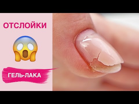 Видео: Причины отслойки гель-лака | Секреты носки маникюра