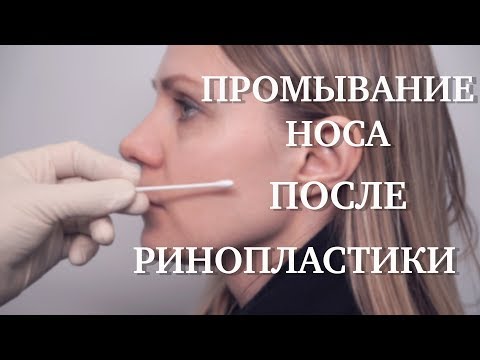 Видео: Как правильно промывать нос? // Ринопластика