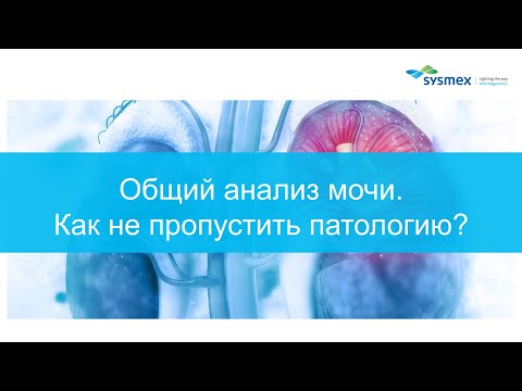Видео: Общий анализ мочи - как не пропустить патологию?