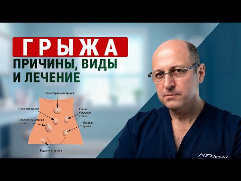 Видео: Грыжа: причины, виды и лечение — советы от доктора Юрия Гольдеса