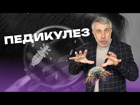 Видео: Педикулез. Не стыдно. Не страшно. Не сложно. - Как? - Сейчас расскажем...
