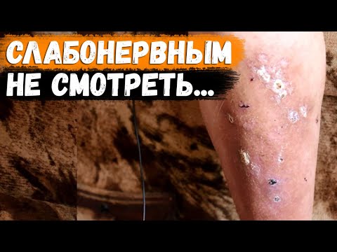 Видео: СЛАБОНЕРВНЫМ НЕ СМОТРЕТЬ! ТЯЖЕЛО СЛУШАТЬ ЕГО ИСТОРИЮ! Страшная судьба!