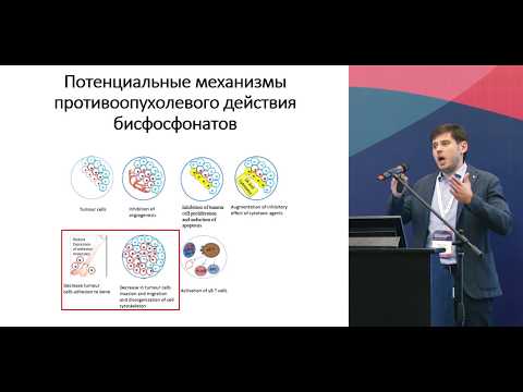 Видео: Бисфосфонаты в адьювантной терапии РМЖ. Противоречивость данных