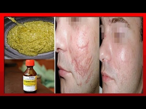 Видео: РУБЦЫ , ШРАМЫ и РАСТЯЖКИ методы лечения