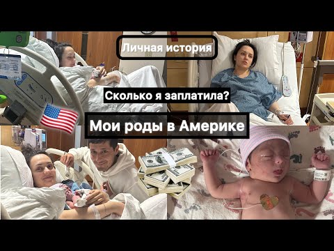 Видео: Роды в США: лучше, чем у нас?