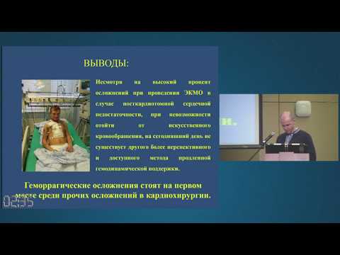Видео: Осложнения при проведении ЭКМО в кардиохирургии  Парфенюк А.В.