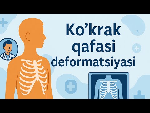 Видео: KO’KRAK QAFASI DEFORMATSIYASI | Dr. JAMSHID MIRDADAEV | КЎКРАК ҚАФАСИ ДЕФОРМАЦИЯСИ