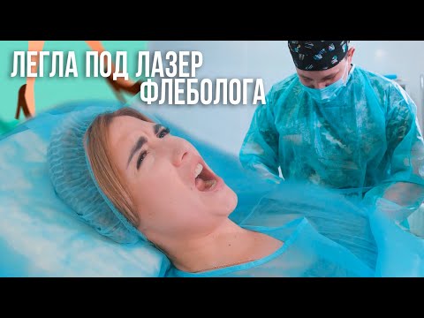 Видео: УДАЛЯЕМ ВЕНЫ ЛАЗЕРОМ - БОЛЬНО?