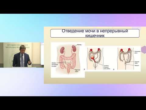 Видео: Принципы хирургического лечения мышечно-инвазивного уротелиального рака мочевого пузыря
