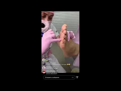 Видео: педикюр Смарт диском с Мульти Бустером