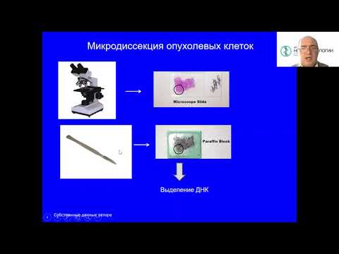 Видео: Возможные ошибки в молекулярной диагностике меланомы и их последствия