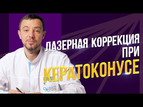 Видео: Лазерная коррекция зрения при кератоконусе