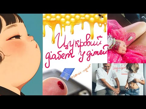 Видео: Цукровий діабет у дітей | Кетоацидотична кома | Гіперосмолярна кома | Гіпоглікемія у дітей лекція