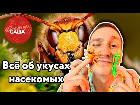 Видео: Всё об укусах насекомых | Доктор Саша