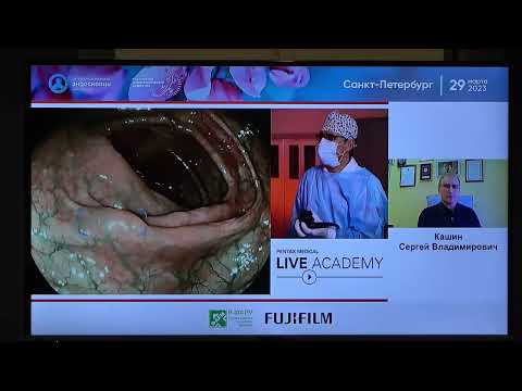 Видео: 31 Fujifilm Cad Eye Искусственный Интеллект 3 Кашин СВ Системы искусственного Ителлекта в практичес