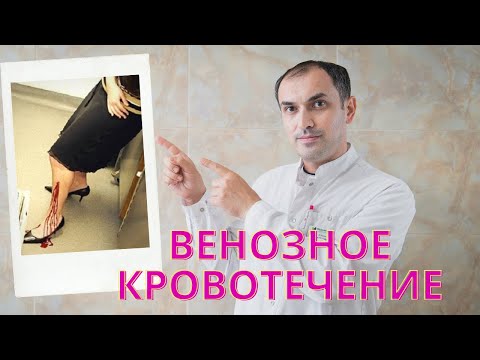 Видео: Венозное кровотечение. Остановка кровотечения. Первая помощь.