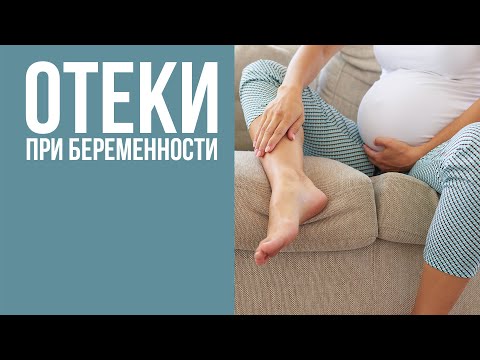 Видео: Что помогает от отеков во время беременности? Причины отечности при беременности