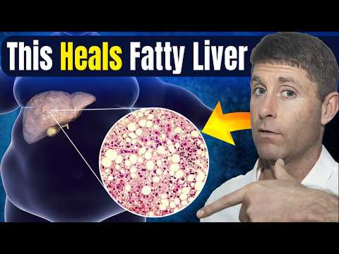 Видео: Проверенный 7-дневный протокол для лечения жировой дистрофии печени (и сжигания опасного жира на ...