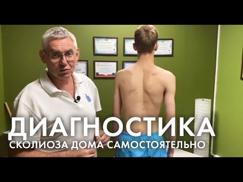 Видео: Тест на сколиоз в домашних условиях. 3 метода диагностики сколиоза.