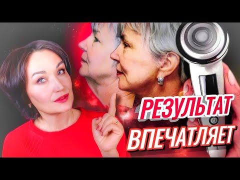 Видео: БЫСТРО УБРАТЬ брыли, пигментацию и подтянуть лицо. Проверенный временем Gezatone RF-1610.