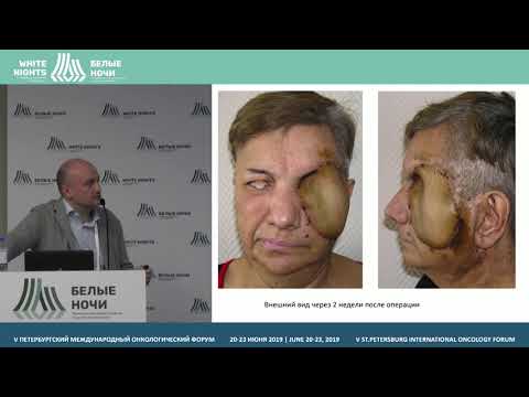 Видео: Особенности реконструктивных вмешательств у больных с рецидивами злокач.  опухолей (Мудунов А.М.)