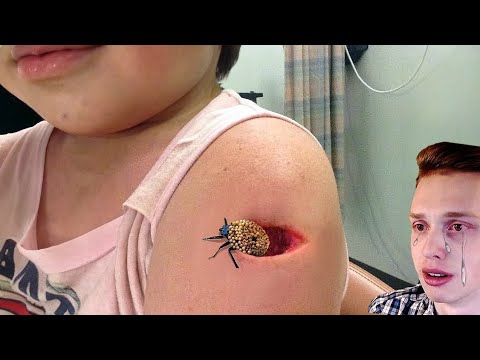 Видео: оно вылезло из моей руки.. помогите!
