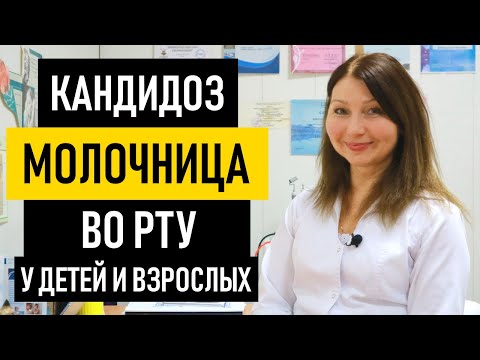 Видео: Молочница во рту: причины, симптомы и лечение. Как лечить кандидоз полости рта