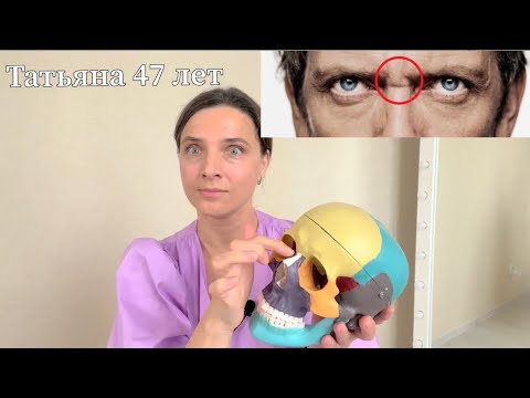 Видео: Морщина на переносице