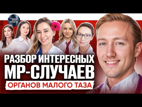 Видео: Разбор случаев, МРТ органов малого таза, Груздев Иван Сергеевич и Замятина Ксения Андреевна