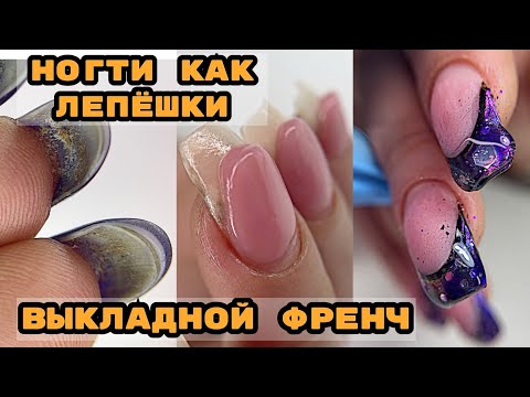 Видео: НОГТИ ЛЕПЕХИ 😅 Выкладной френч на ногтях 💅 Френч пошагово 💅 Как поднять клюющий ноготь