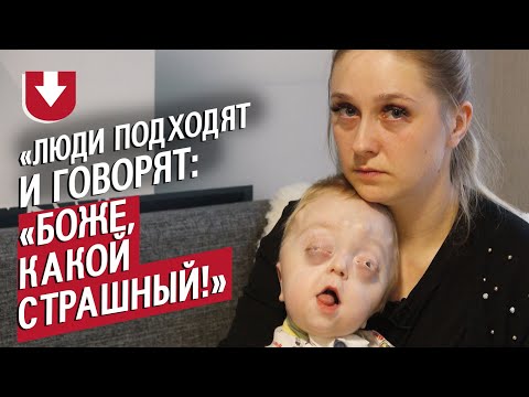 Видео: У моего сына синдром Пфайффера: Катя | Быть мамой