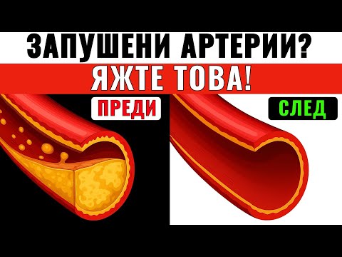 Видео: „7 традиционни храни, които почистват артериите и укрепват сърцето“