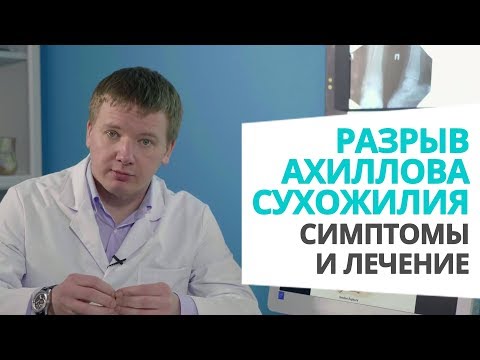 Видео: Разрыв ахиллова сухожилия: симптомы и лечение доктор Алексей Олейник #footclinic