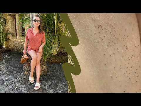 Видео: ЭЛЕКТРОЭПИЛЯЦИЯ Ч.2: КАК ВЫБРАТЬ МАСТЕРА / КОРОЧКИ - ЭТО НОРМА? / ПОЧЕМУ ТАК ДОРОГО / ЭЭ НА ЛИЦЕ