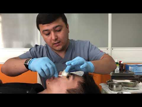 Видео: Международная клиника Ибни Сино, Душанбе, Таджикистан, др. Нозим Шокирович.